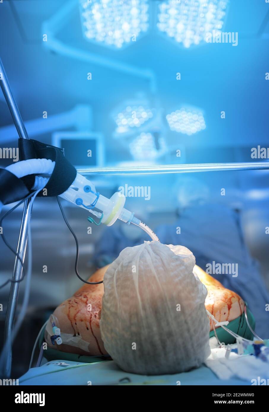 Patient sur la table sous la lampe sugical, concept de services médicaux d'urgence. Banque D'Images