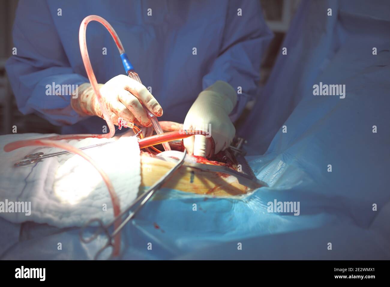 Chirurgien travaillant avec du sang sur des gants. Banque D'Images