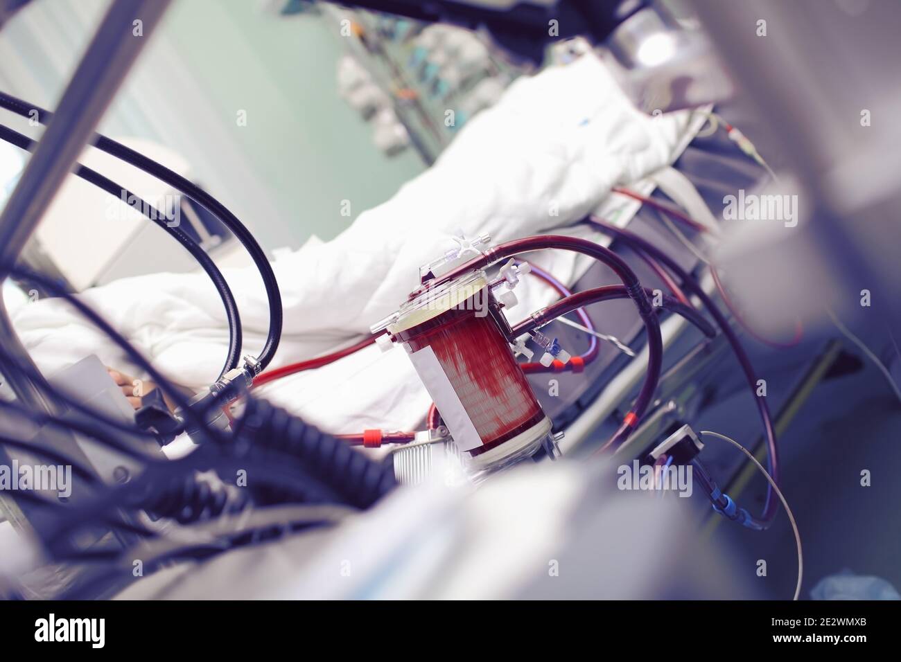 Machine cœur-poumon travaillant en unité de soins intensifs. Banque D'Images