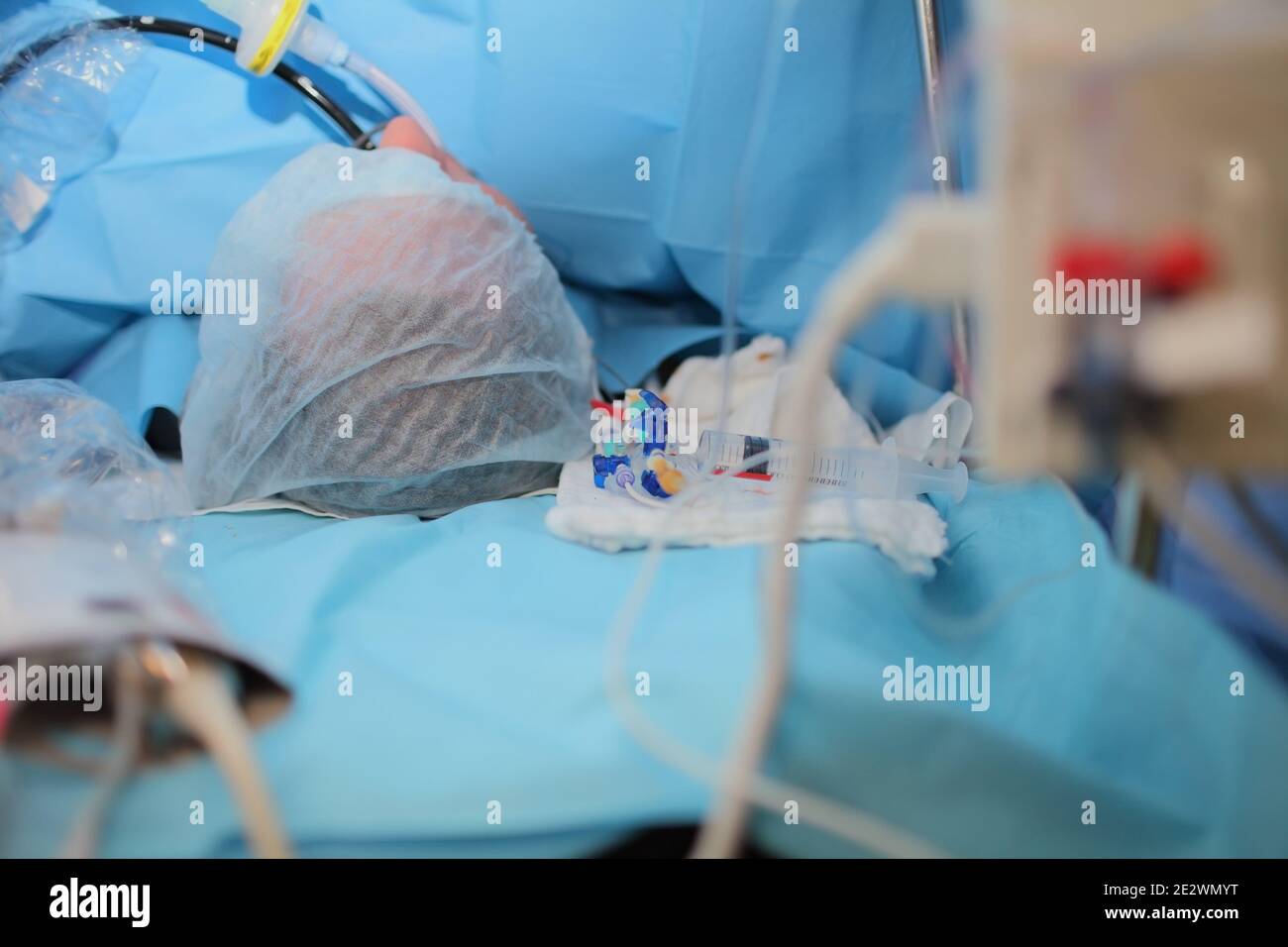 Patient sur la table pendant la chirurgie. Banque D'Images