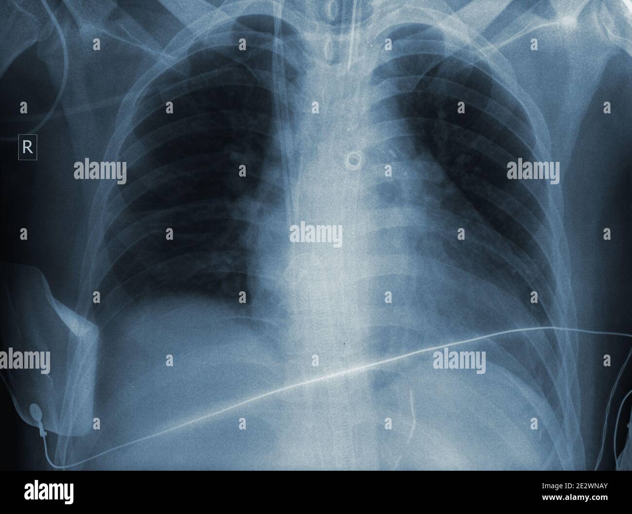 Résultat d'un examen radiologique. Banque D'Images
