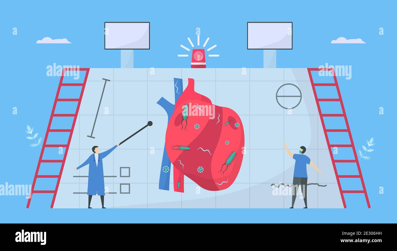 Cardiologie et examen de cette maladie appelle endocardite. C'est une infection de l'endocarde qui est des chambres et des valves cardiaques internes. Bactéries, parasite an Illustration de Vecteur