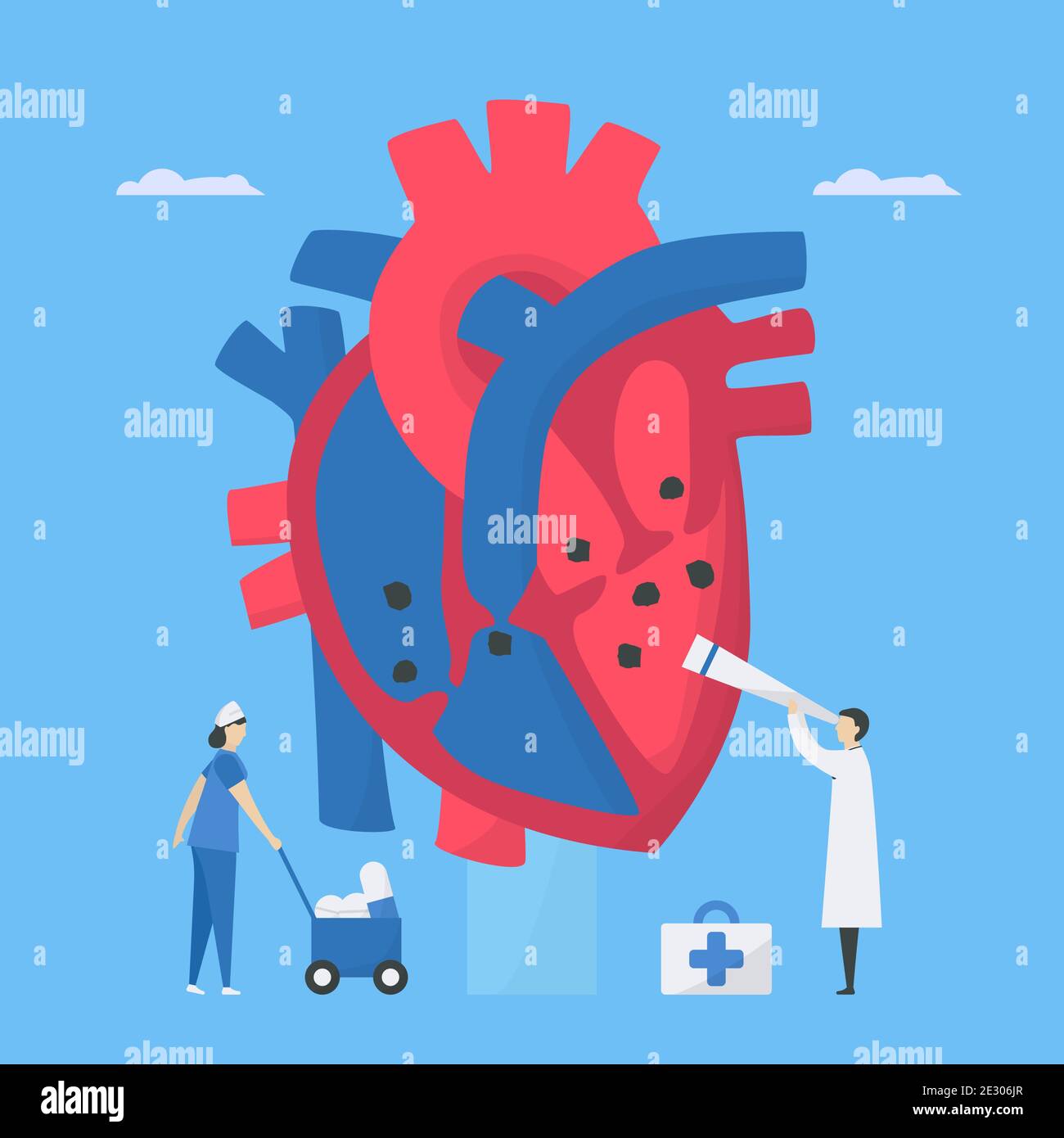 Illustration du vecteur cardiologique. Cette maladie appelle endocardite. C'est une infection de l'endocarde qui est des chambres et des valves cardiaques internes. Diagnostic an Illustration de Vecteur
