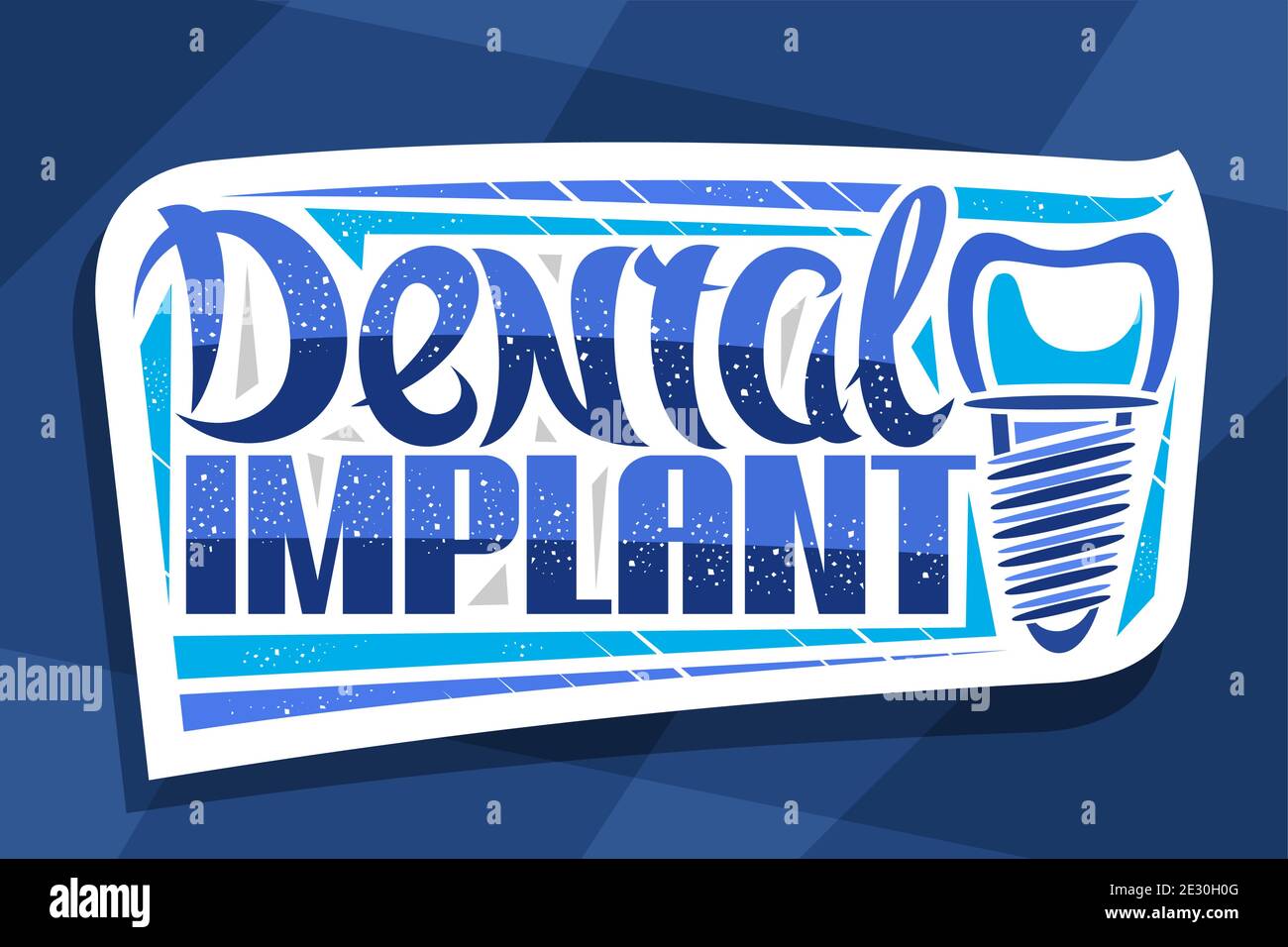 Logo Vector pour la clinique d'implant dentaire, badge en papier découpé décoratif avec illustration de la dent humaine avec vis, panneau d'affichage pour la cli professionnelle des prothèses dentaires Illustration de Vecteur