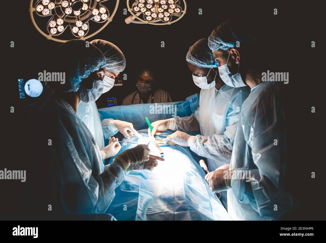 Une équipe professionnelle internationale de chirurgien, d'assistants et d'anesthésiste effectue une opération complexe sur un patient sous anesthésie générale. Sombre Banque D'Images