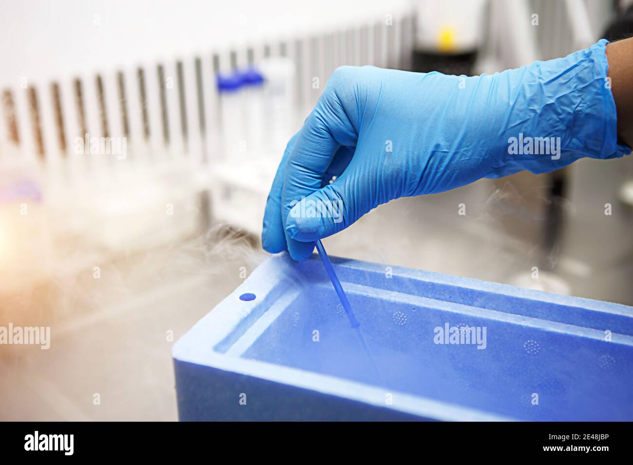 Mains d'un scientifique en laboratoire avec un tube à essai et un microscope. L'invention du vaccin, un médecin dans la clinique de l'inséminat artificiel Banque D'Images