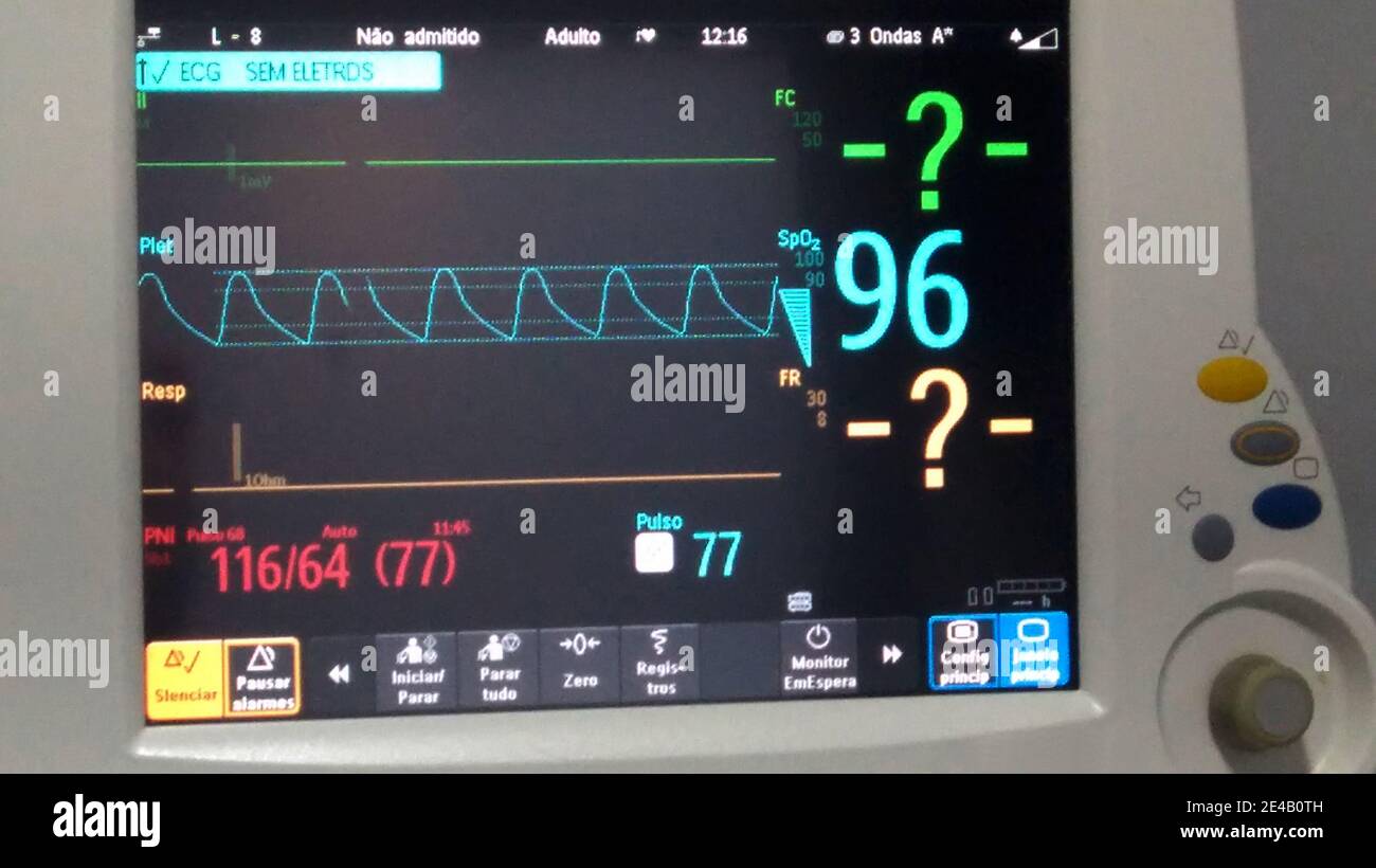 Signes vitaux, unité de réanimation, chirurgie ambulatoire, São Paulo, Brésil Banque D'Images