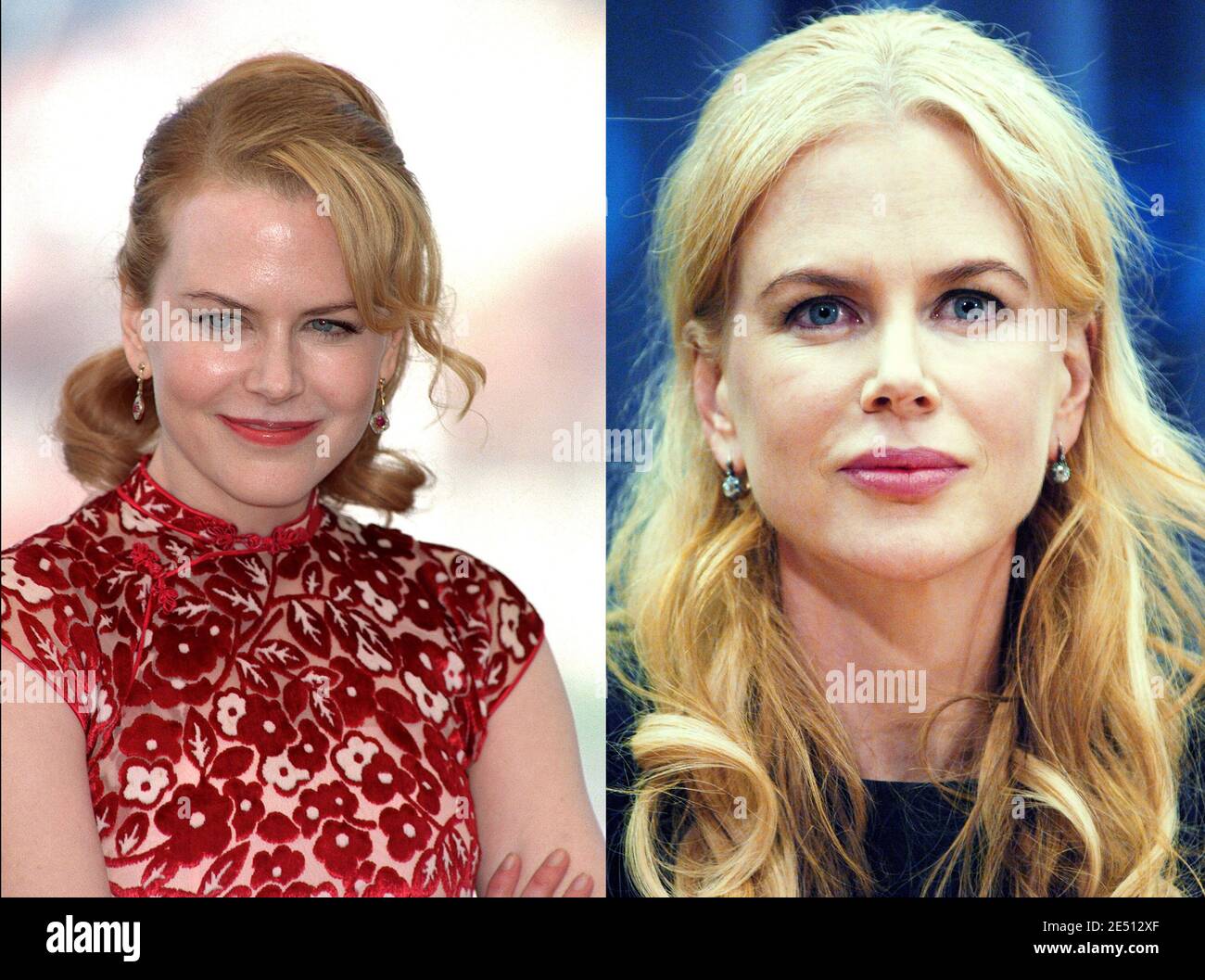 Photomontage représentant Nicole Kidman avant et après l'augmentation