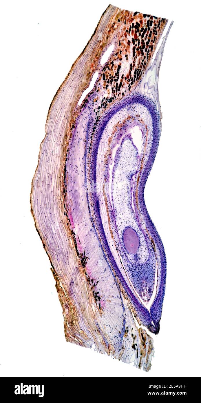 PIN écossais, Pinus sylvestris, ovule LS, photomicrographe à fond clair Banque D'Images