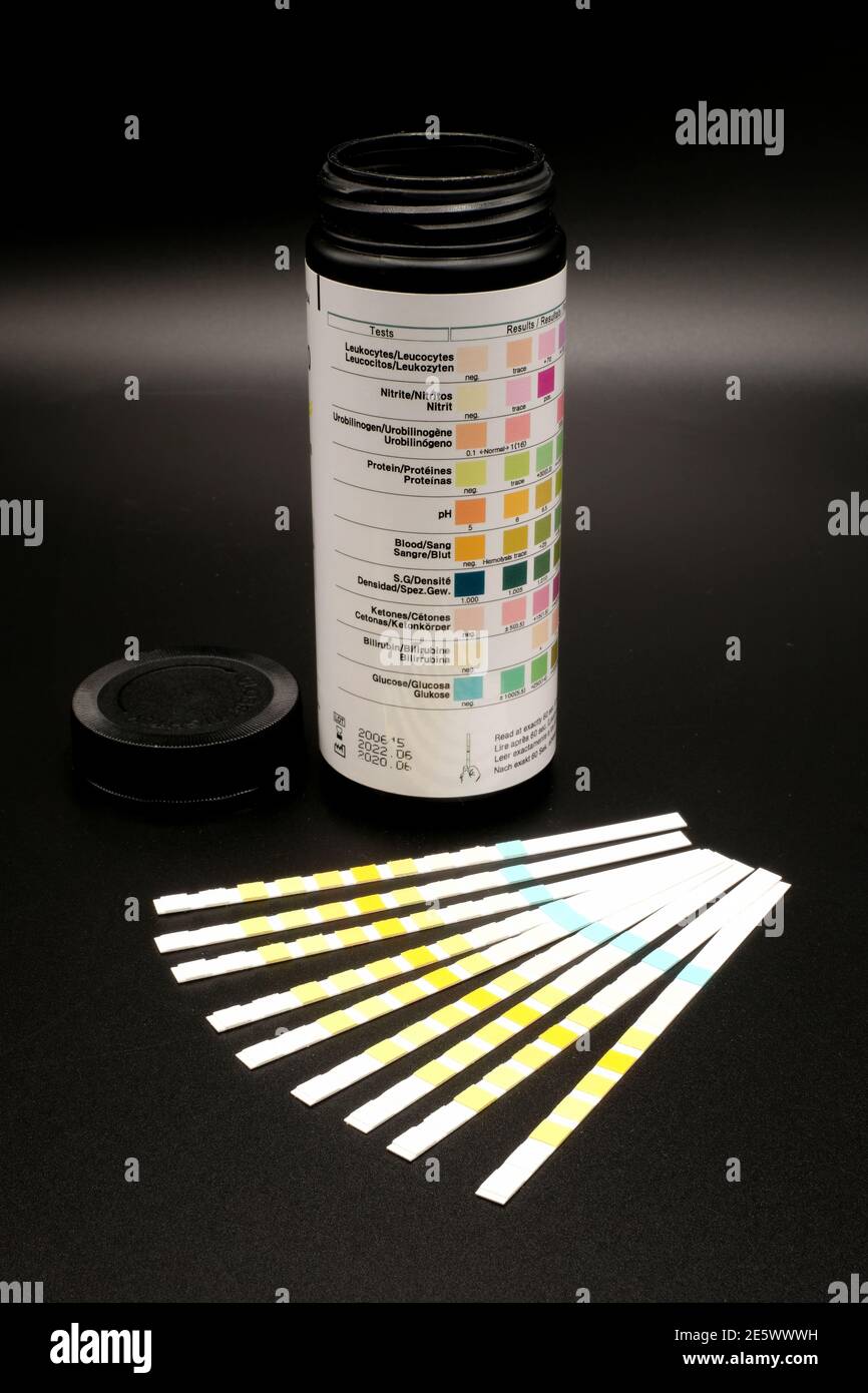 Bandelettes de test urinaire pour déterminer 10 valeurs - glucose, bilirubine, cétone, concentration urinaire, sang, pH, protéine, urobilinogène, nitrite, leucocytes Banque D'Images