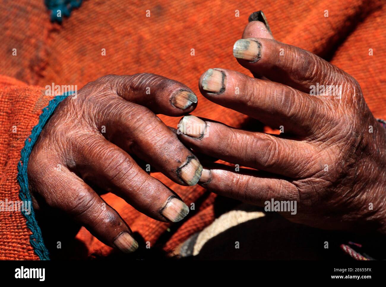Les mains d'Aymara Indian Carmelo Flores sont photographiées lors d'une  interview avec Reuters TV dans sa ville natale de Frasquia, à 68 km au nord  de la Paz, le 16 août 2013.