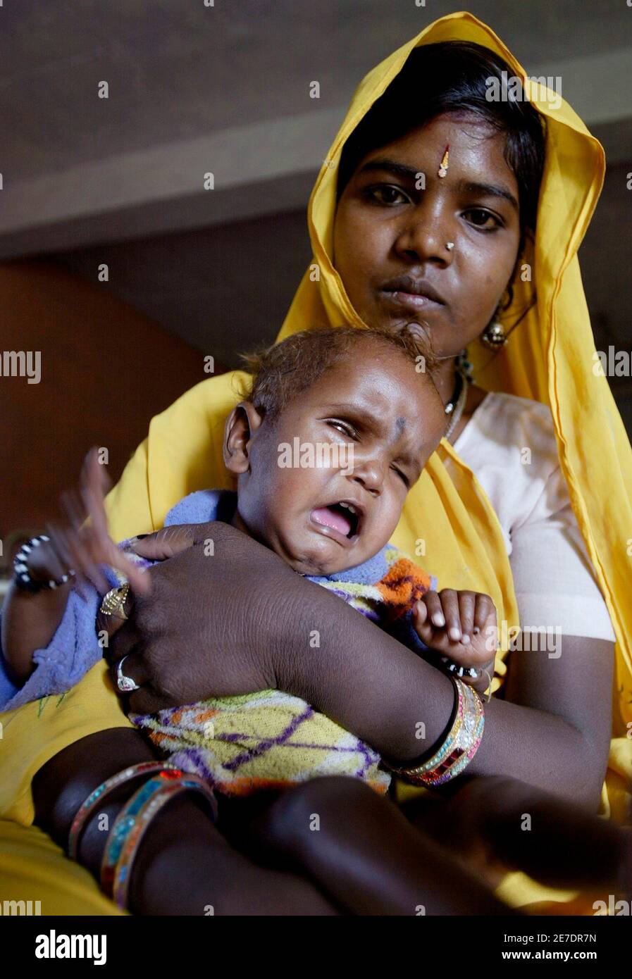 Sheela Adivasi A Son Fils De 18 Mois Deepak Dans Un Centre De Readaptation Nutritionnelle Nrc Du Bloc Badarwas Dans Le Centre De L Etat Indien Du Madhya Pradesh Le 7 Mars 08 Sheela Adivasi A Son Fils De 18 Mois Deepak Dans Un Centre De Readaptation Nutritionnelle Nrc Du Bloc Badarwas Dans Le Centre De L Etat Indien Du Madhya Pradesh Le 7 Mars 08