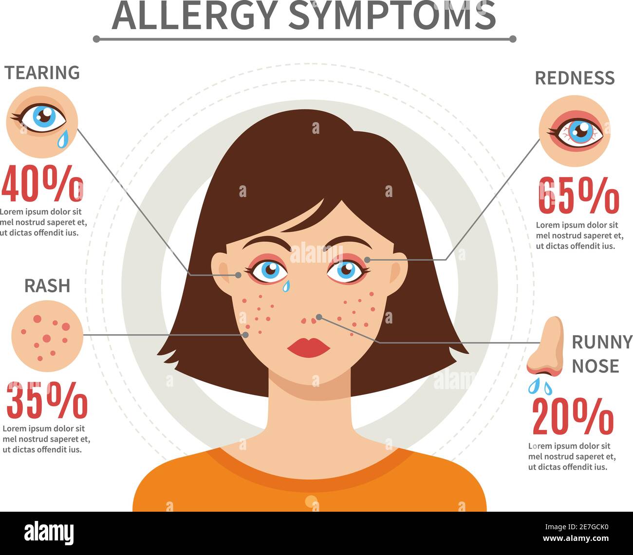 Symptômes d'allergie modèle plat concept avec larmoiement éruption rougeur et illustration du vecteur nasal liquide Illustration de Vecteur