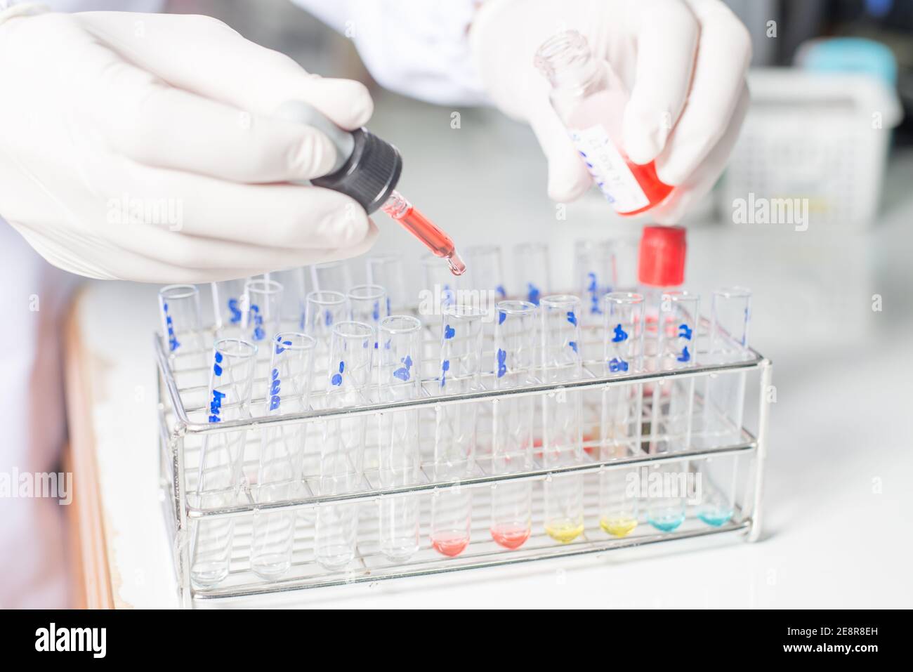 Gros plan des tubes à essai disposés sur un plateau dans un laboratoire médical. Analyse médicale de santé dans un hôpital. Science, chimie, technologie, biologie et Banque D'Images