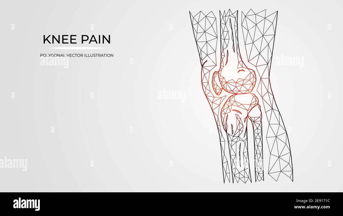 Illustration vectorielle polygonale de douleur, d'inflammation ou de blessure dans la vue latérale du genou. Anatomie des os des jambes humaines. Modèles de maladies orthopédiques médicales Illustration de Vecteur