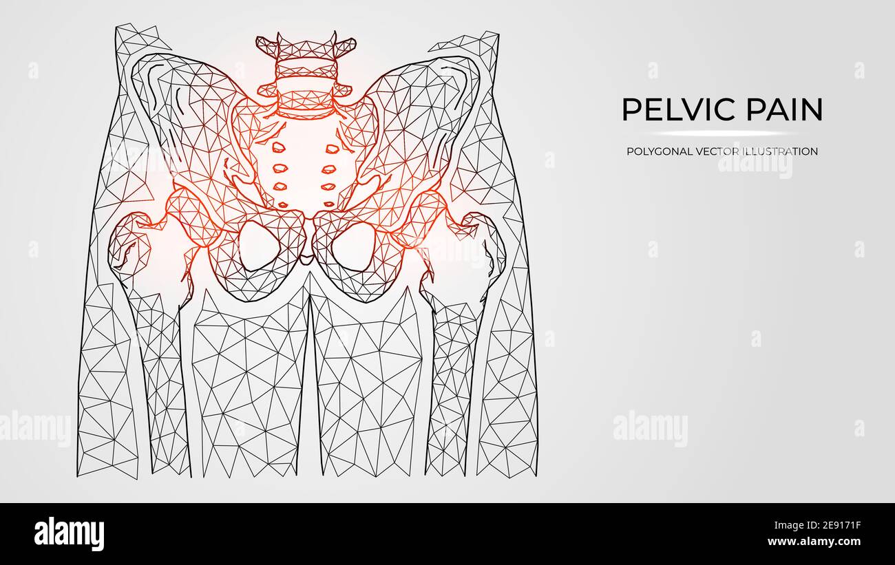 Illustration vectorielle polygonale de la douleur, de l'inflammation ou de la blessure dans le bassin et l'articulation de la hanche. Modèles de maladies orthopédiques médicales Illustration de Vecteur