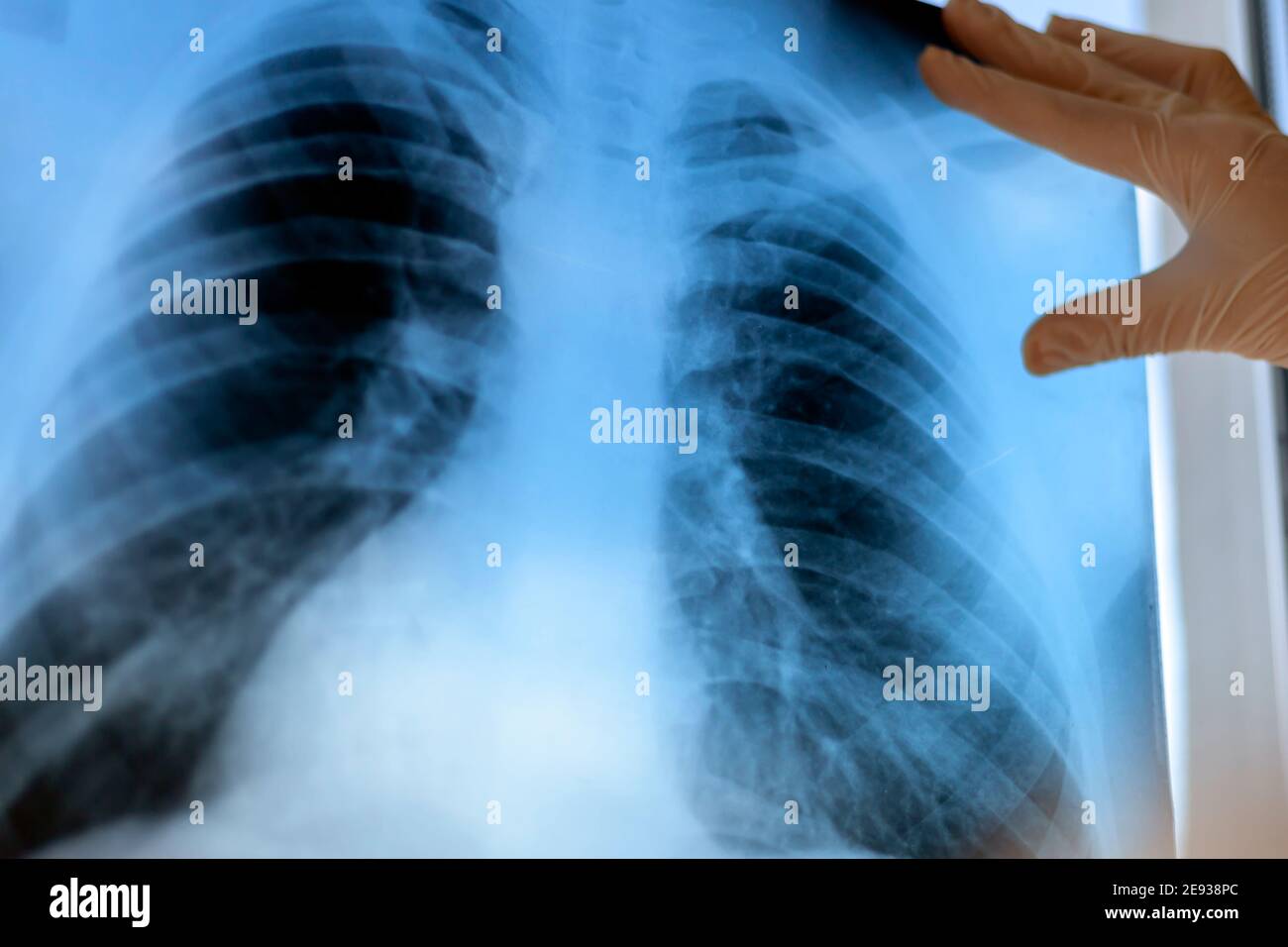 Une pneumologue tient une acquisition pulmonaire dans ses mains. Banque D'Images