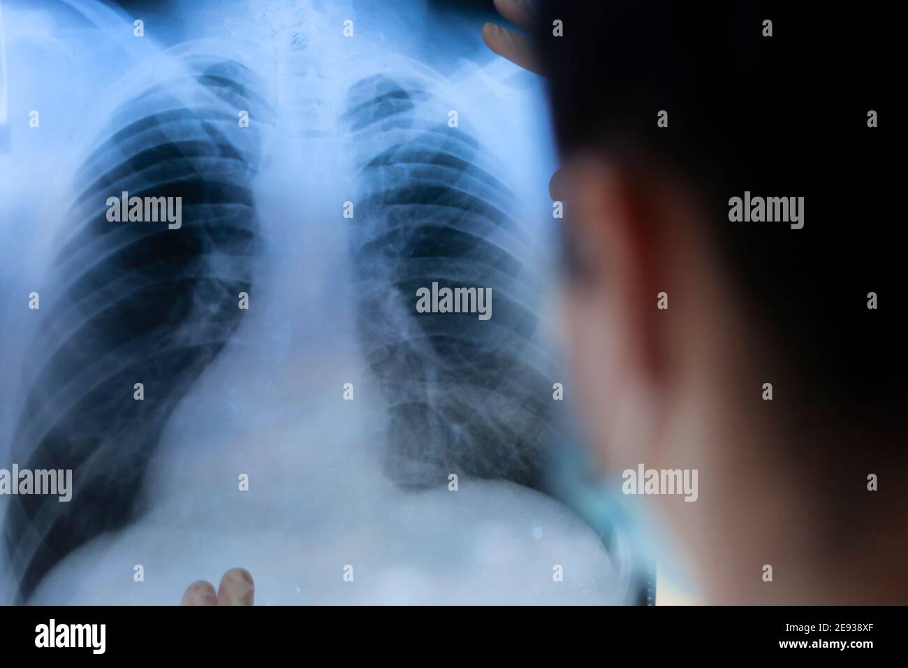 Une pneumologue tient une acquisition pulmonaire dans ses mains. Banque D'Images