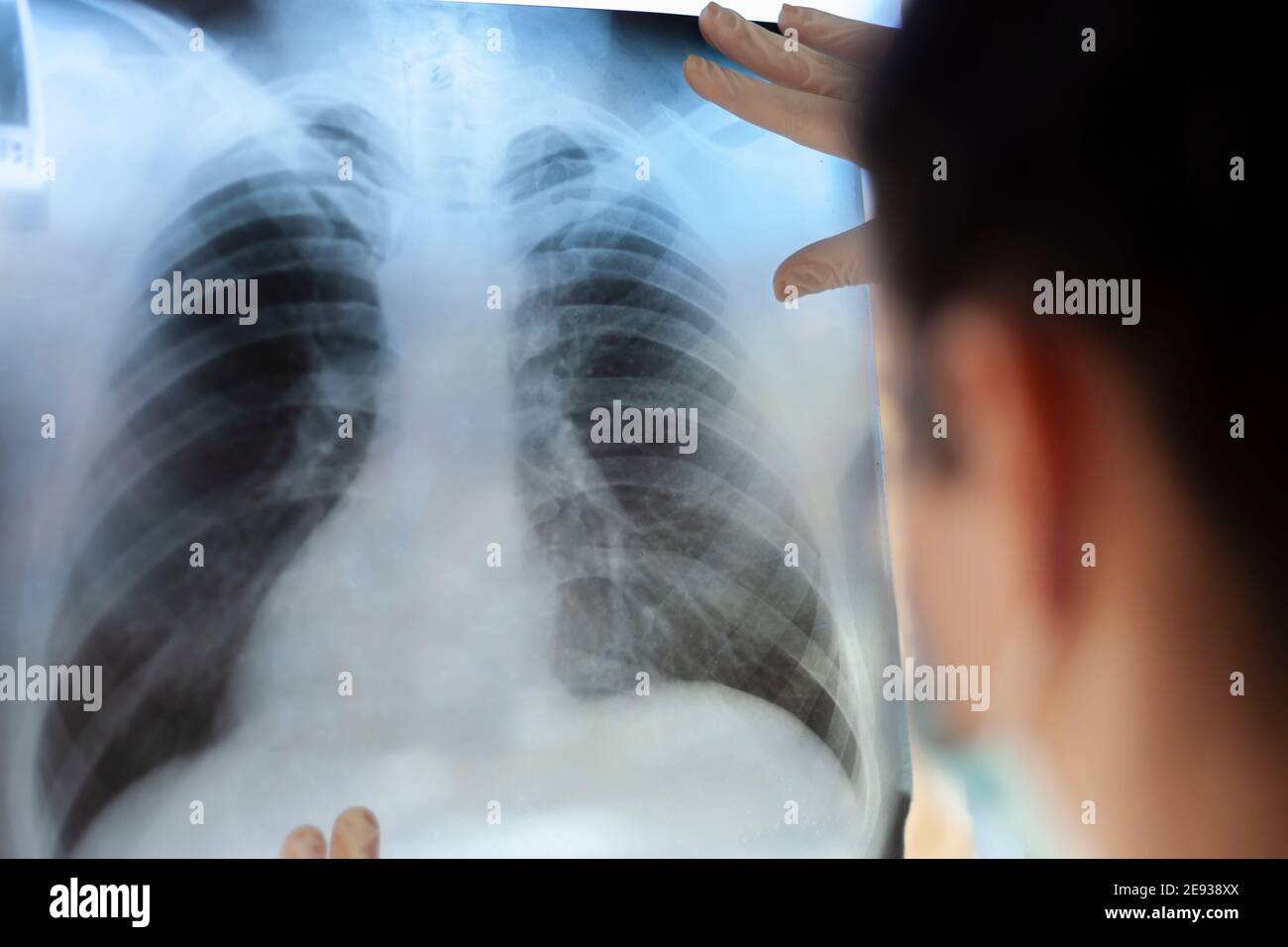 Une pneumologue tient une acquisition pulmonaire dans ses mains. Banque D'Images