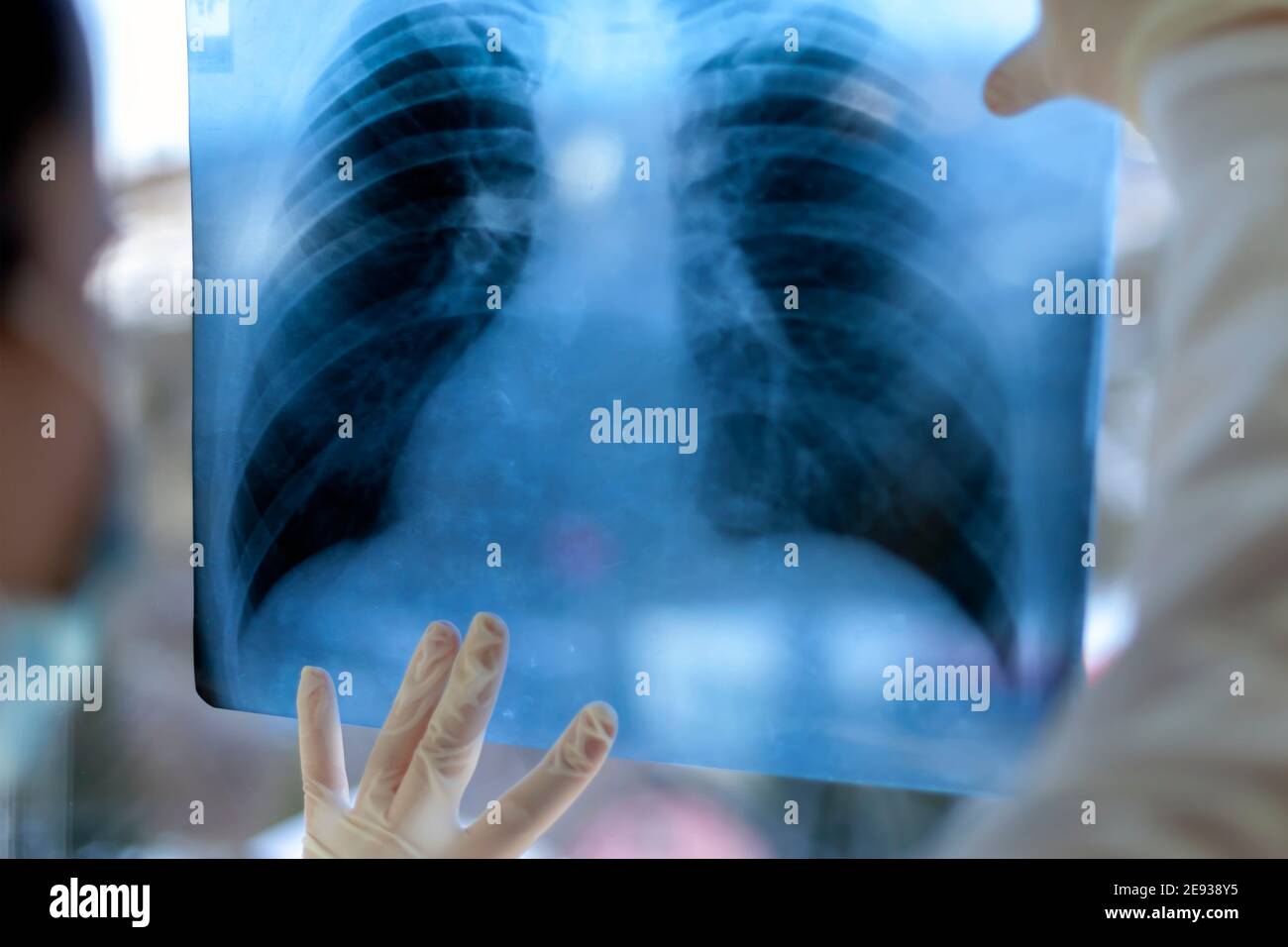 Une pneumologue tient une acquisition pulmonaire dans ses mains. Banque D'Images