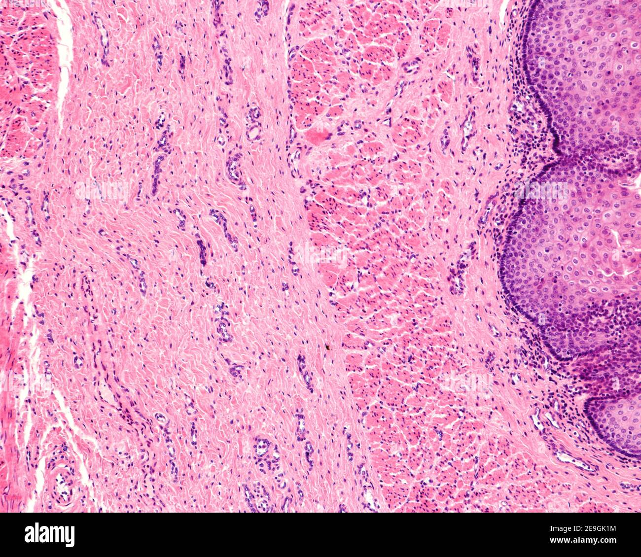 Oesophage. De droite à gauche : épithélium stratifié, lamina propria, une muqueuse muscularis bien développée (avec muscle lisse orienté longitudinalement f Banque D'Images