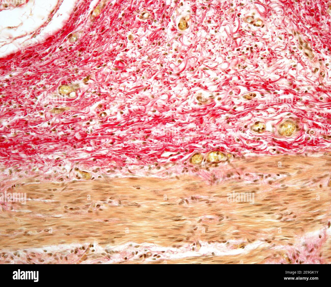 Couche sous-muqueuse de l'oesophage montrant d'abondants faisceaux de fibres de collagène colorées en rouge, et quelques vaisseaux sanguins sectionnés. "Ci-dessous, le muscle. Banque D'Images