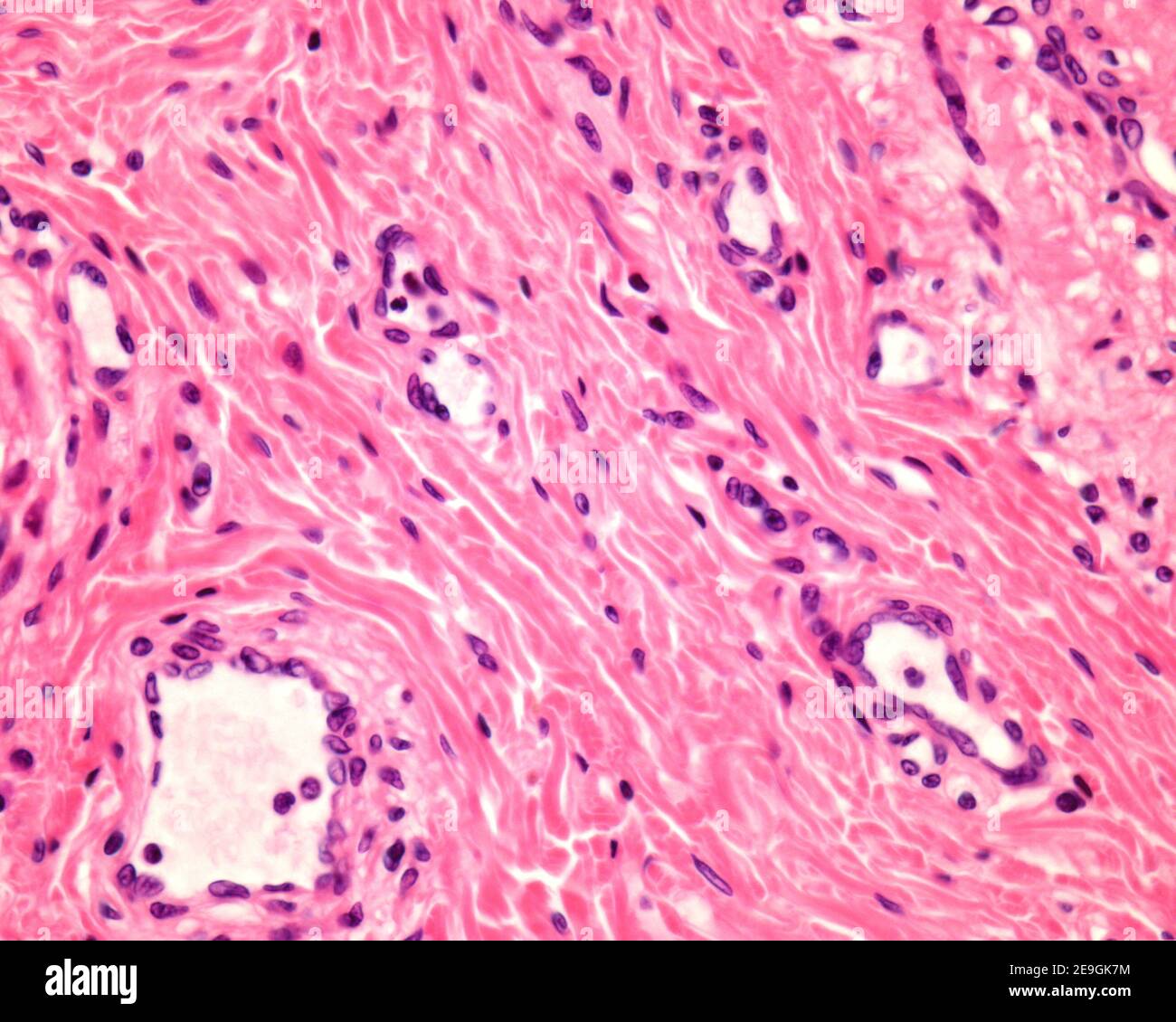 Couche sous-muqueuse de l'oesophage. Il contient du tissu conjonctif, avec des faisceaux de fibres de collagène, des cellules de tissu conjonctif et plusieurs vaisseaux sanguins Banque D'Images
