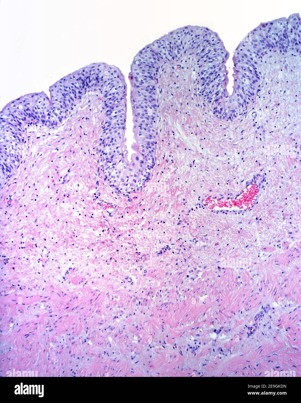 Muqueuse de la vessie urinaire formée par un épithélium transitoire et une lamina propria du tissu conjonctif. Ci-dessous, la couche musculaire formée par smoot Banque D'Images
