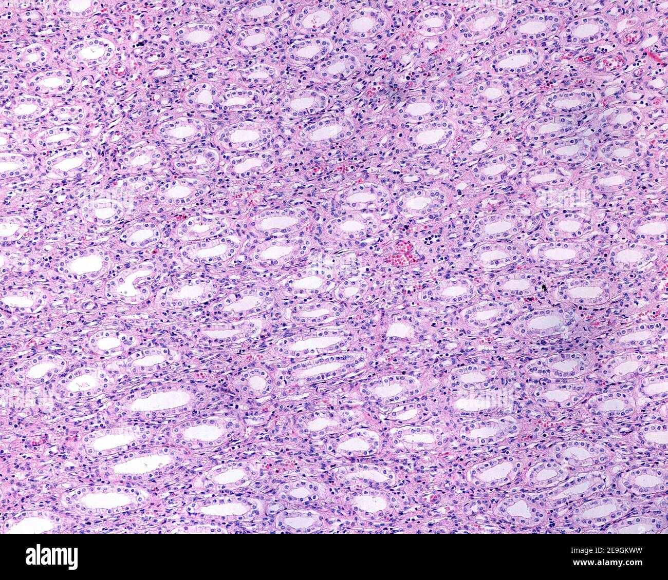 Micrographe à faible grossissement montrant le médullaire d'un rein humain. Les grands canaux de collecte sont connu comme des conduits papillaires de Bellini. Banque D'Images