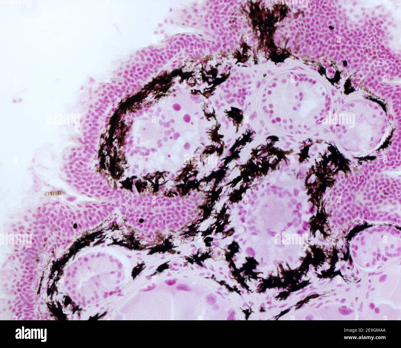 Photomicrographie des cellules pigmentaires (chromatophores) dans la peau d'un nouveau-ton, (Pleurodeles waltl). Les chromatophores sont des cellules chargées de grains de pigments, Locate Banque D'Images