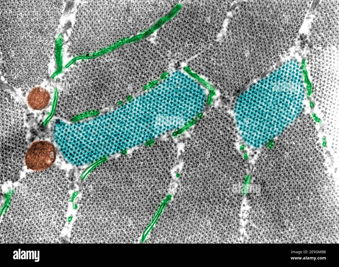 Micrographe TEM (faux microscope électronique à transmission de couleurs) montrant les myofibrilles à coupe croisée Au niveau DE la bande A et deux sections (bleues) au niveau de H Banque D'Images