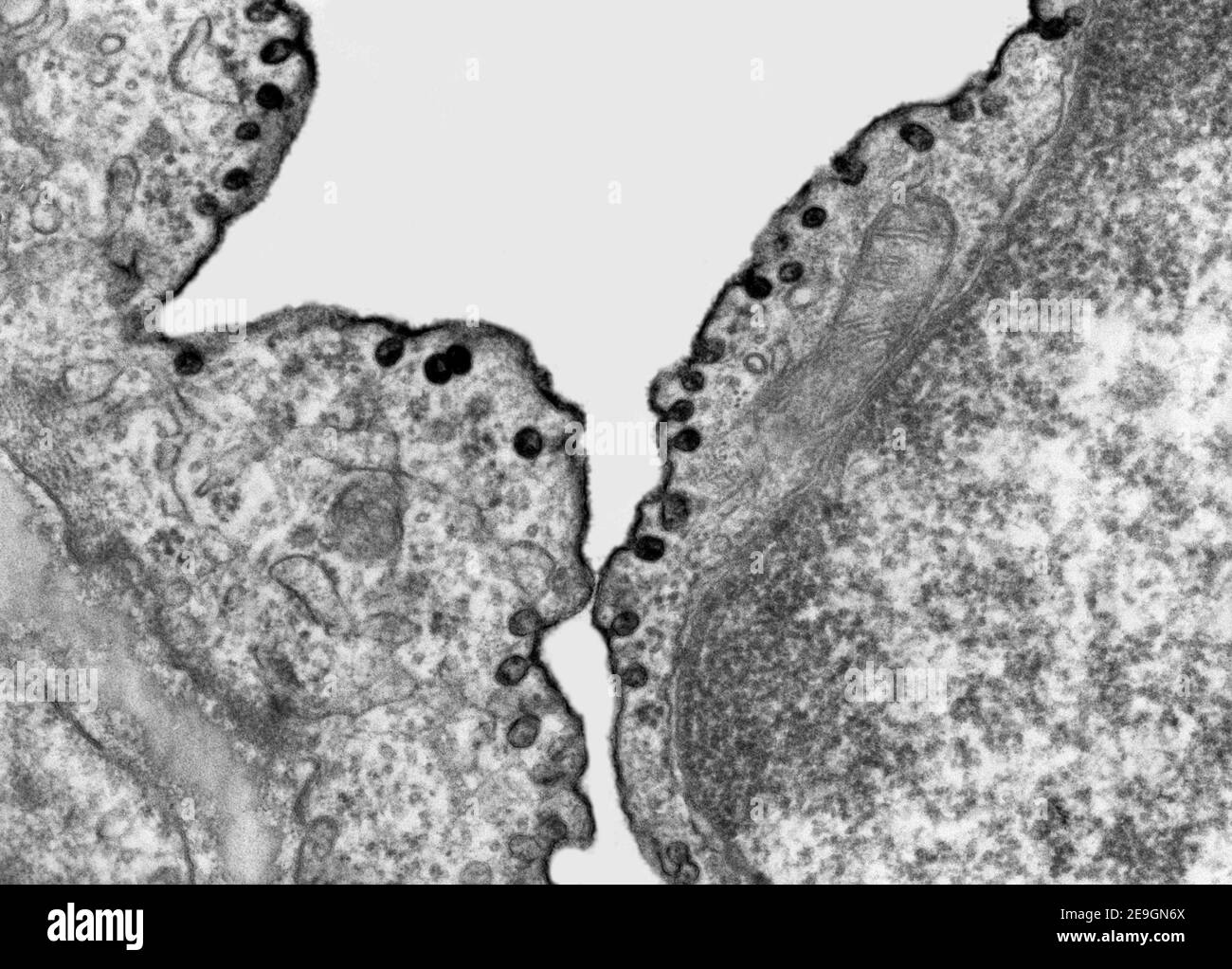 Microscope électronique à transmission (TEM) micrographe montrant le marquage des vésicules de la pinocytose avec un marqueur dense aux électrons, le rouge de ruthénium. Banque D'Images