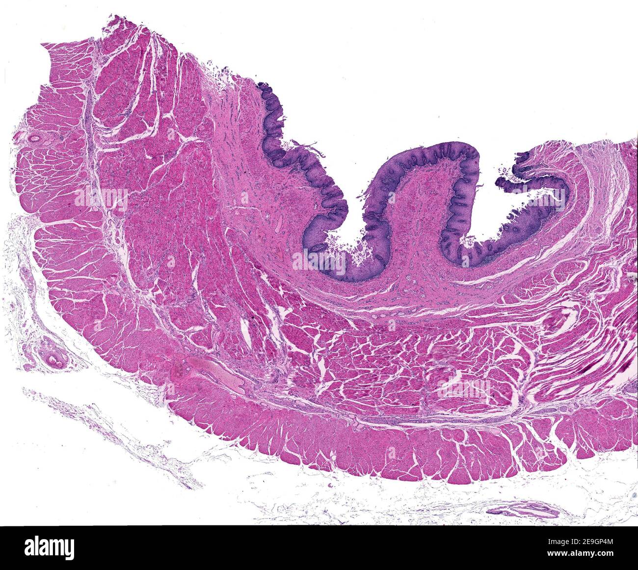 Micrographe à faible grossissement montrant les couches de la paroi d'un oesophage humain : muqueuse, sous-muqueuse, musculaire et adventice. Banque D'Images