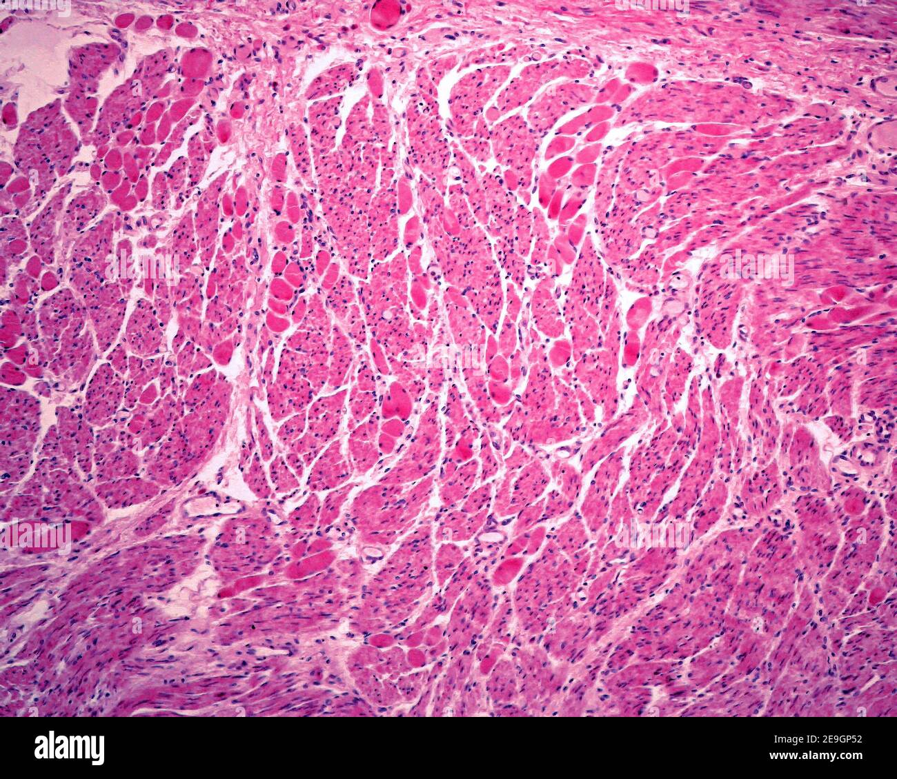 Couche musculaire de l'oesophage montrant un mélange de fibres musculaires lisses et de fibres musculaires striées (grands cercles rougeâtres). Banque D'Images