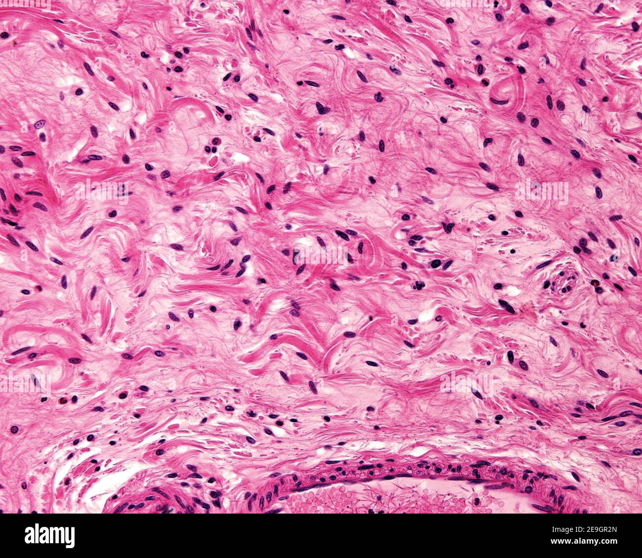 Exemple d'un tissu conjonctif généralement lâche appartenant à la sous-muqueuse de l'estomac. Le collagène apparaît comme des fibres isolées et des faisceaux de fibres ondulés. Banque D'Images