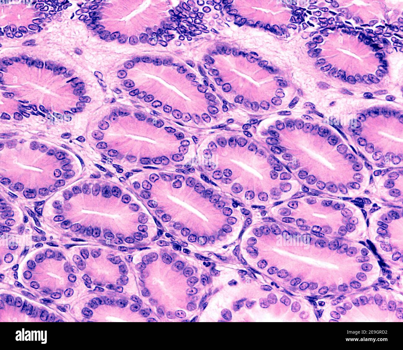 Coupe transversale de fosses gastriques bordées par l'épithélium de surface de l'estomac, formé par des cellules sécrétrices de mucus appelées cellules foveolaires Banque D'Images