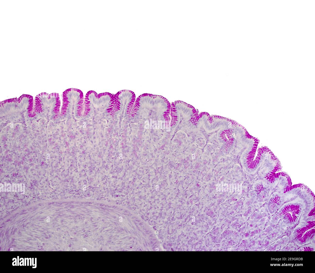 Muqueuse gastrique colorée avec la technique de l'acide périodique Schiff (pas) Montrant la positivité intense du pas de l'épithélium de surface et du fovéolaire cellules Banque D'Images