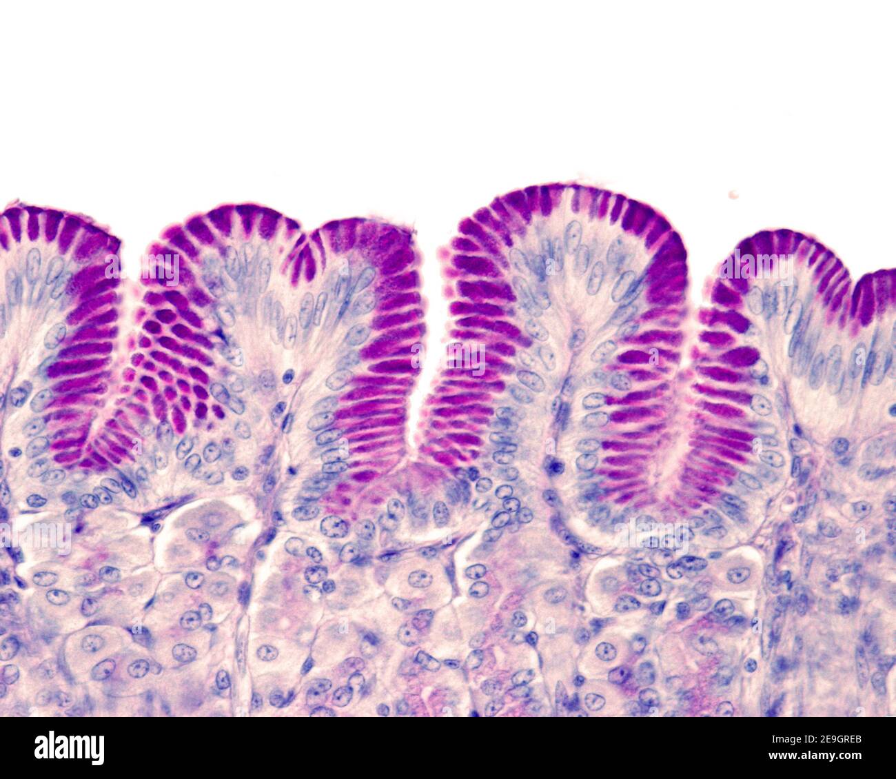 Muqueuse gastrique colorée avec la technique de l'acide périodique Schiff (pas) Montrant la positivité intense du pas de l'épithélium de surface et du fovéolaire cellules Banque D'Images
