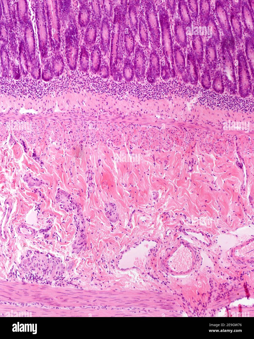 Paroi de l'intestin grêle. De haut en bas : cryptes de Lieberkühn, muscularis mucosae, sous-muqueuse (avec gros vaisseaux sanguins) et couche musculaire interne Banque D'Images