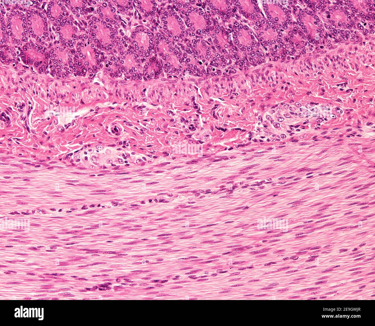 Plexus de Meissner dans la sous-muqueuse du tube digestif montrant deux petits ganglions contenant des corps cellulaires de neurones. Banque D'Images