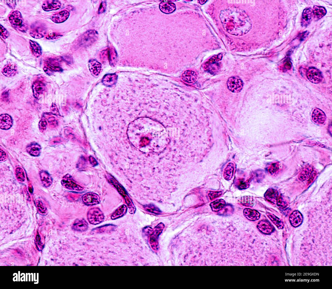 Micrographe à fort grossissement d'un neurone pseudo-bipolaire d'un ganglion de la racine dorsale. La région pâle dans le cytoplasme est le hillock axone. IL Banque D'Images