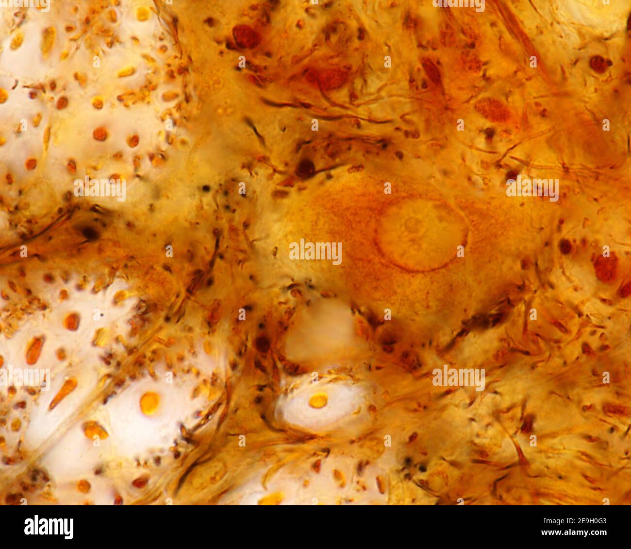 Synapses terminales multiples sur le corps cellulaire d'un neurone moteur de la corne antérieure de la moelle épinière. La réduction du nitrate d’argent de Cajal. Banque D'Images
