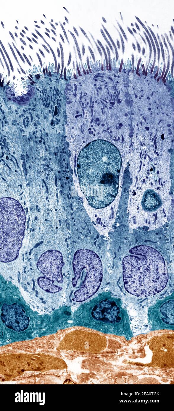 Doublure trachée, TEM Banque D'Images