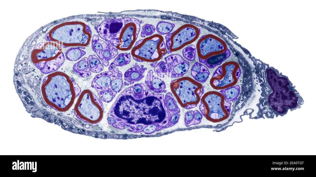 Nerf périphérique, TEM Banque D'Images