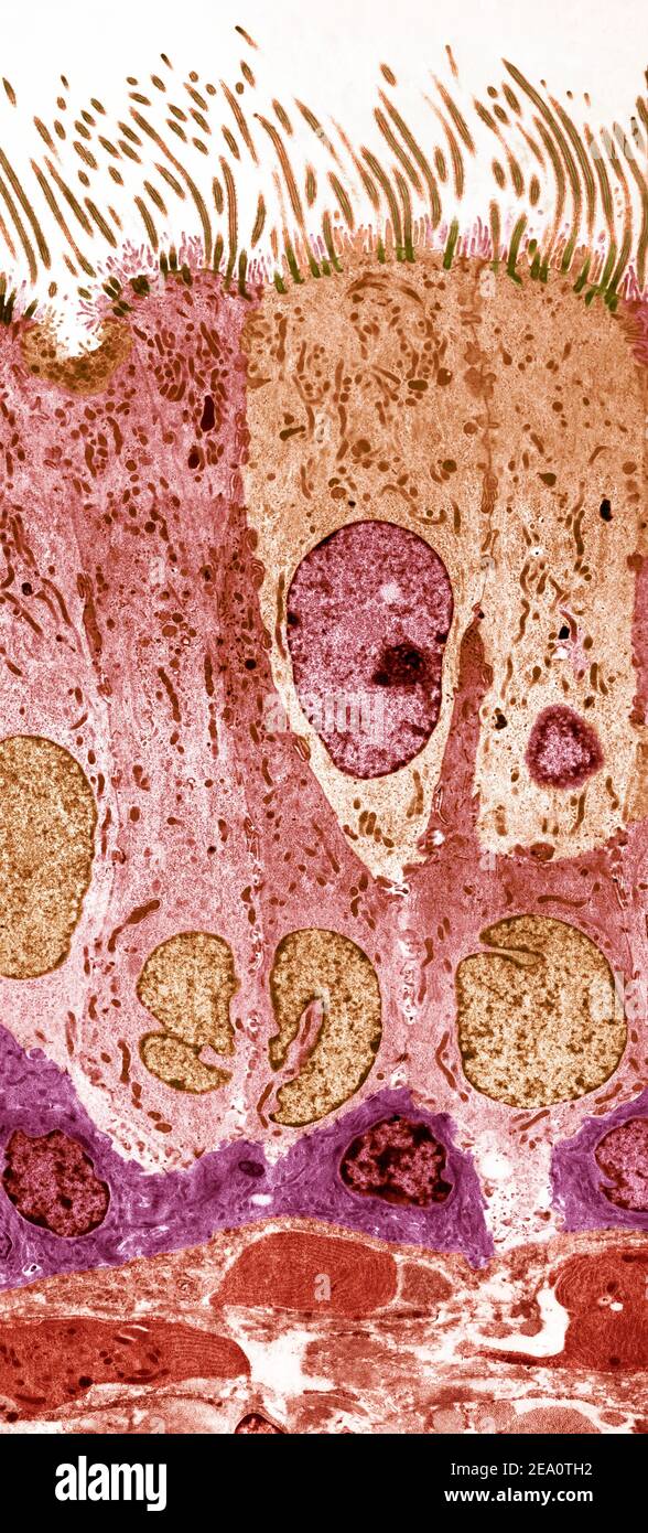 Doublure trachée, TEM Banque D'Images