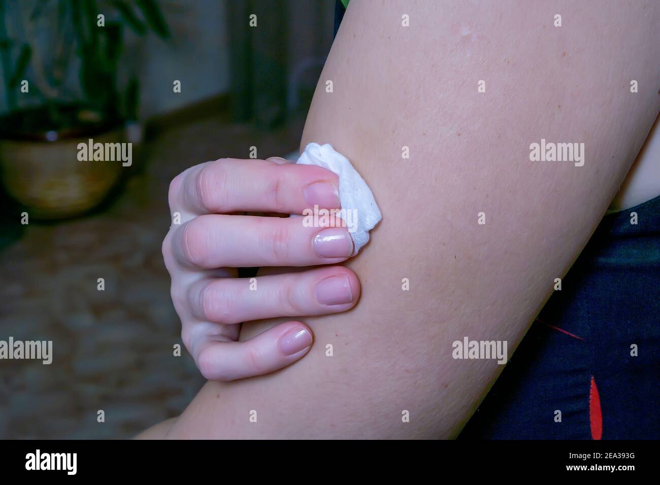 après l'injection dans le muscle de la main, la femme tient un coton-tige Banque D'Images