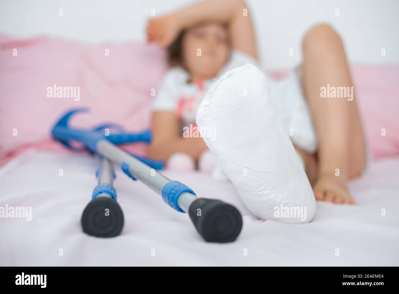 Une adolescente se trouve sur un lit avec du plâtre sur sa jambe, avec une fracture de l'articulation de la cheville et des béquilles. Jambes fracturées dans un enfant.gros plan Banque D'Images