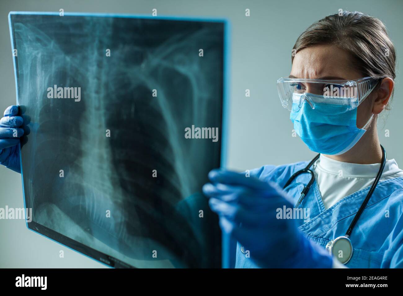 Femme médecin généraliste tenant un examen de film radiographique de poitrine, femme médicale travailleur Examen des poumons du patient pendant le coronavirus maladie respiratoire aiguë sévère Banque D'Images