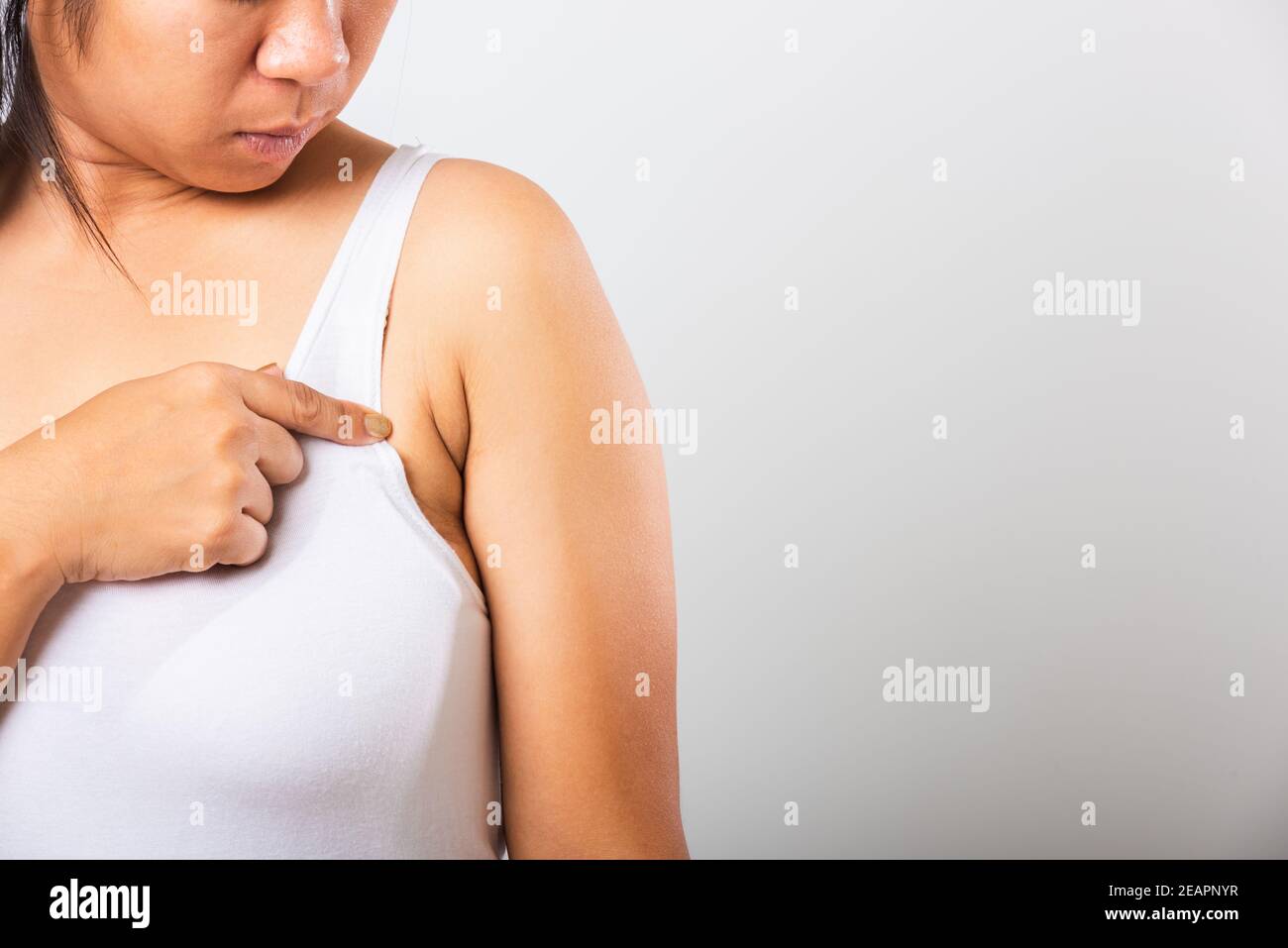 Femme pointant sa peau sous les bras elle problème de graisse de l'aisselle  sous les bras peau froissée Photo Stock - Alamy