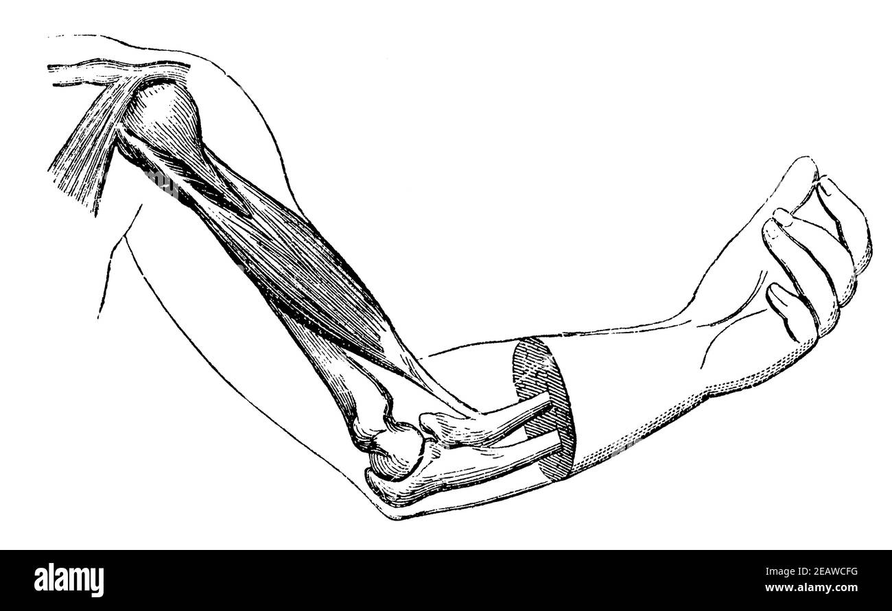 Les biceps se sont contractés à moitié. Illustration du 19e siècle. Allemagne. Arrière-plan blanc. Banque D'Images